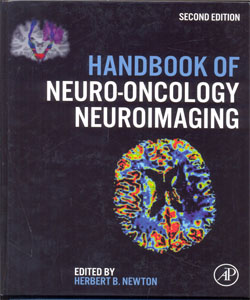 Handbook of Neuro-Oncology Neuroimaging 2Ed.