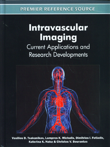 Intravascular Imaging: Current Applications and Research Developments