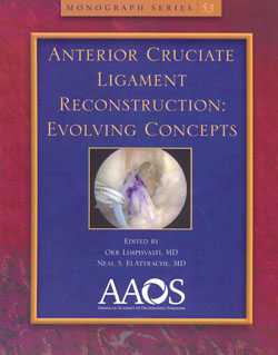 Anterior Cruciate Ligament Reconstruction Evolving Concepts