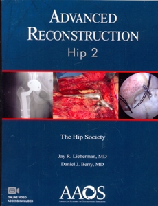 Advanced Reconstruction Hip 2