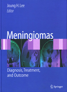 Meningiomas
