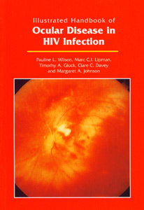 Ocular Disease in HIV Infection
