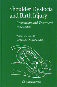 Shoulder Dystocia and Birth Injury