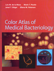 Color Atlas of Herpetic Eye Disease